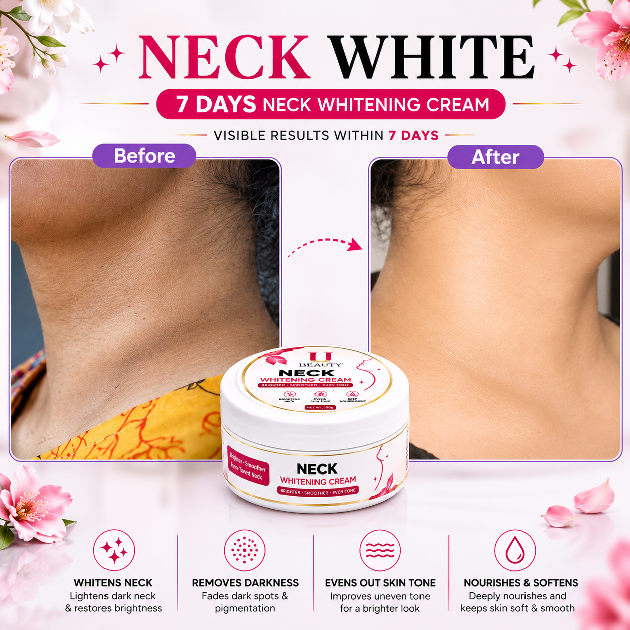 7 DAYS NECK WHITENING CREAM
