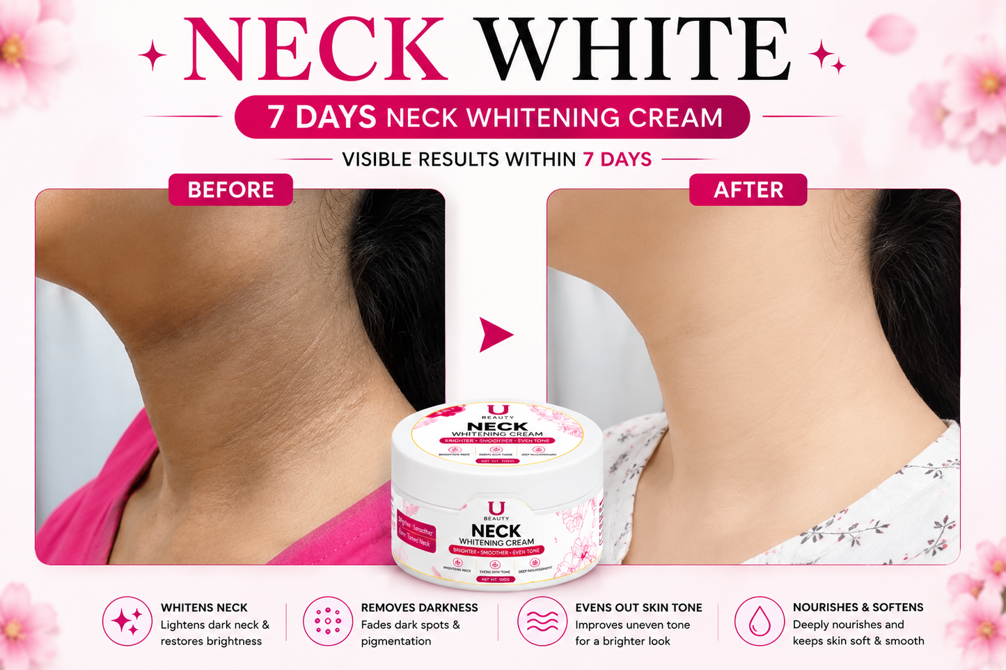7 DAYS NECK WHITENING CREAM