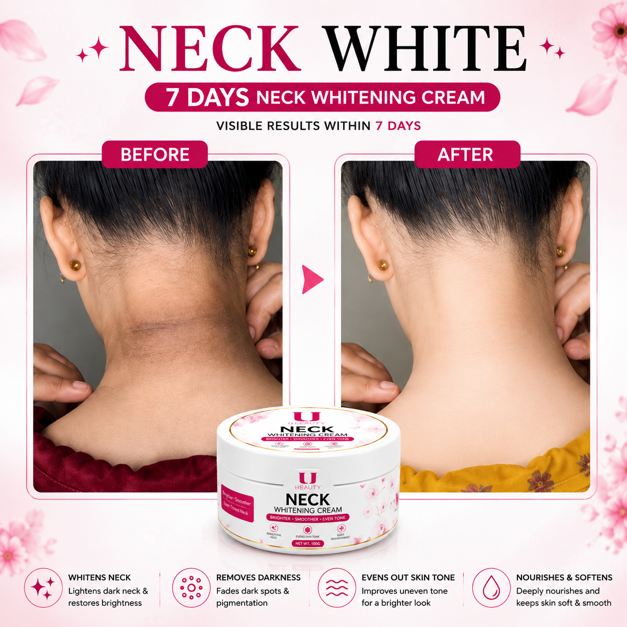 7 DAYS NECK WHITENING CREAM