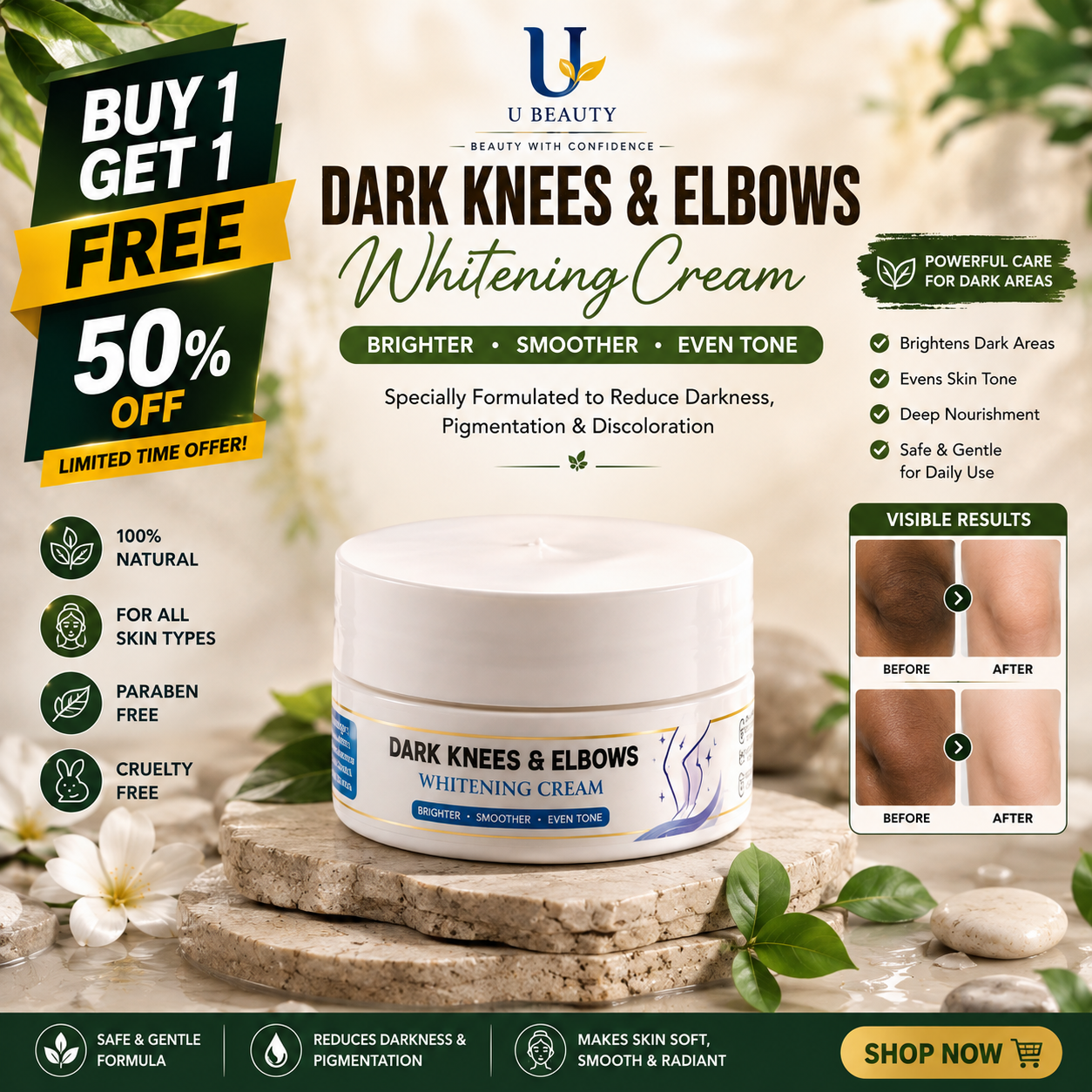 DARK KNESS & ELBOWS WHITENING CREAM