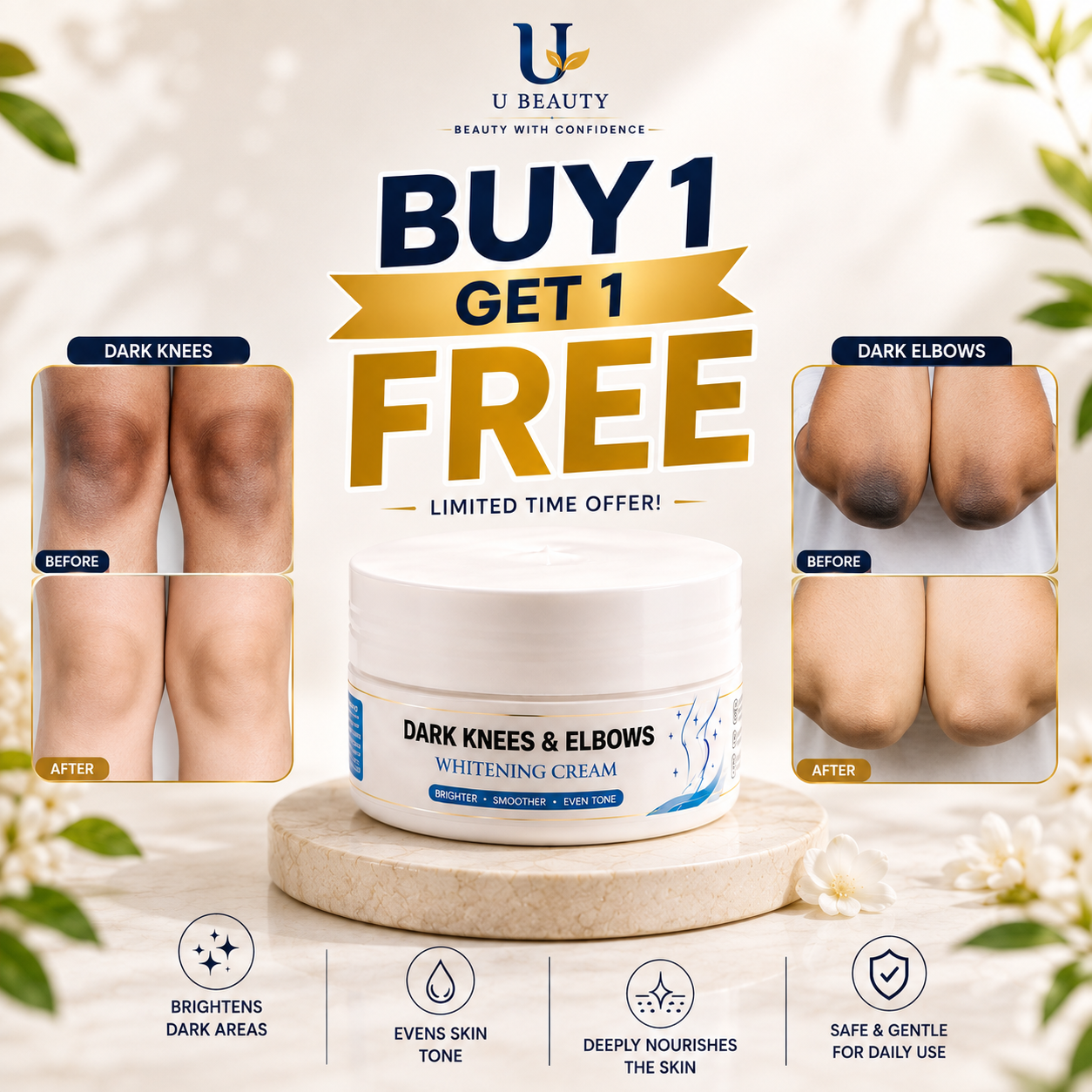 DARK KNESS & ELBOWS WHITENING CREAM