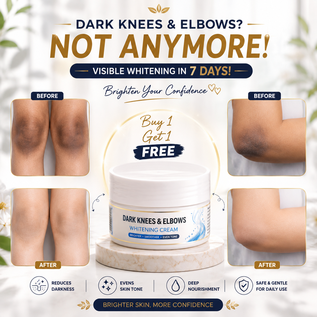 DARK KNESS & ELBOWS WHITENING CREAM