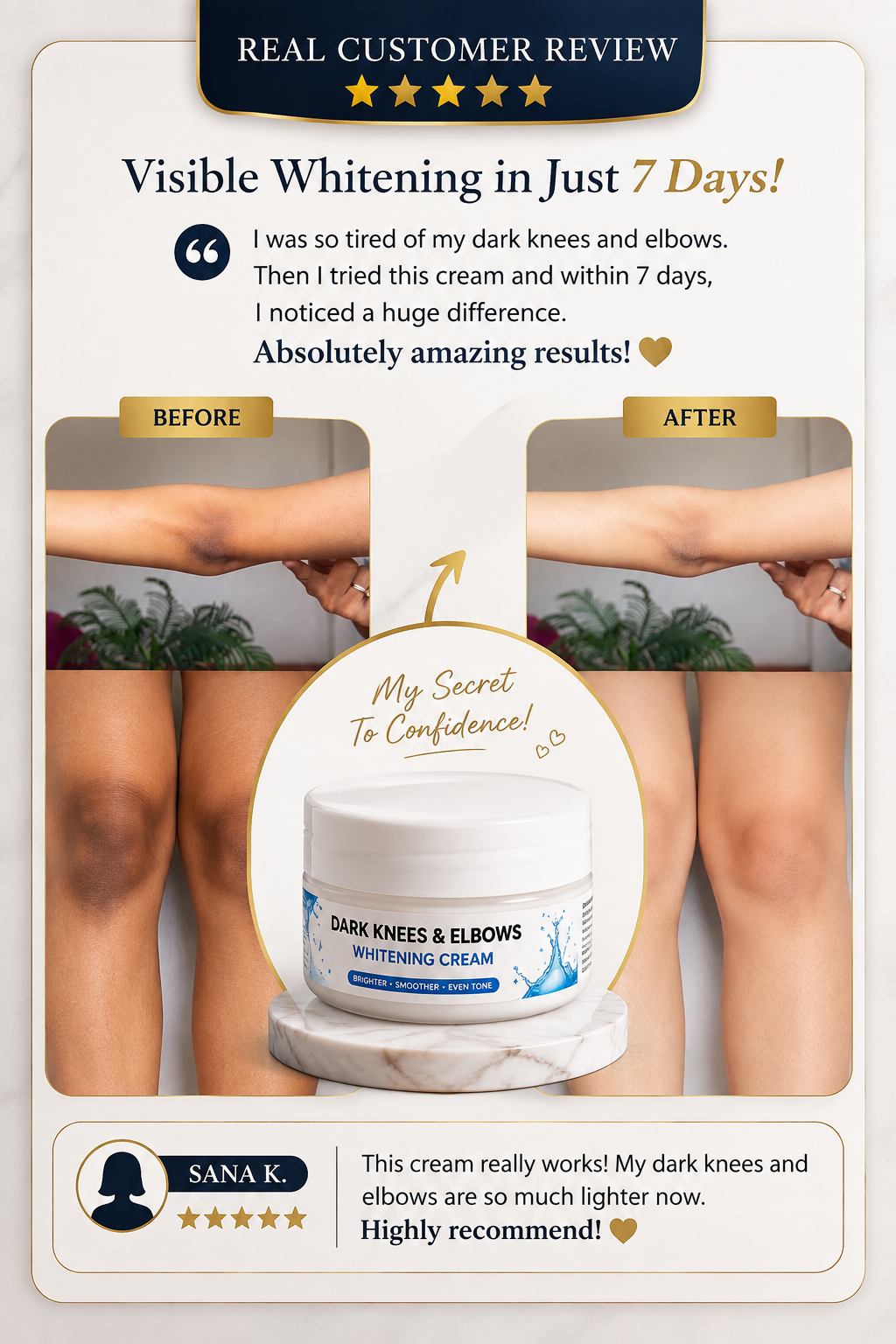 DARK KNESS & ELBOWS WHITENING CREAM