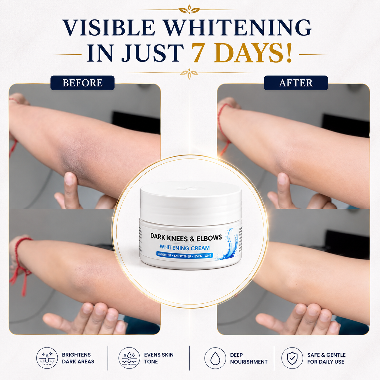 DARK KNESS & ELBOWS WHITENING CREAM