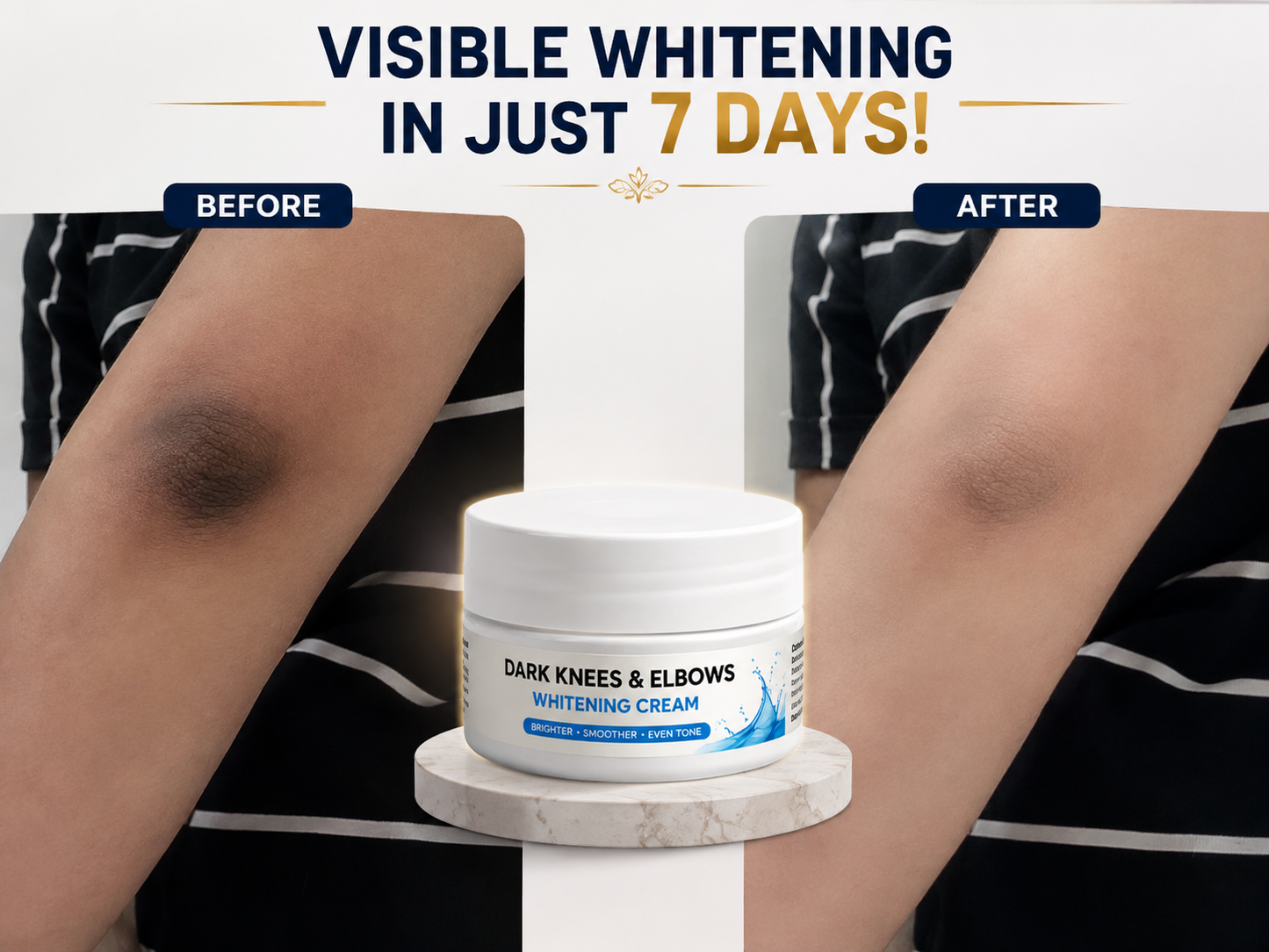 DARK KNESS & ELBOWS WHITENING CREAM