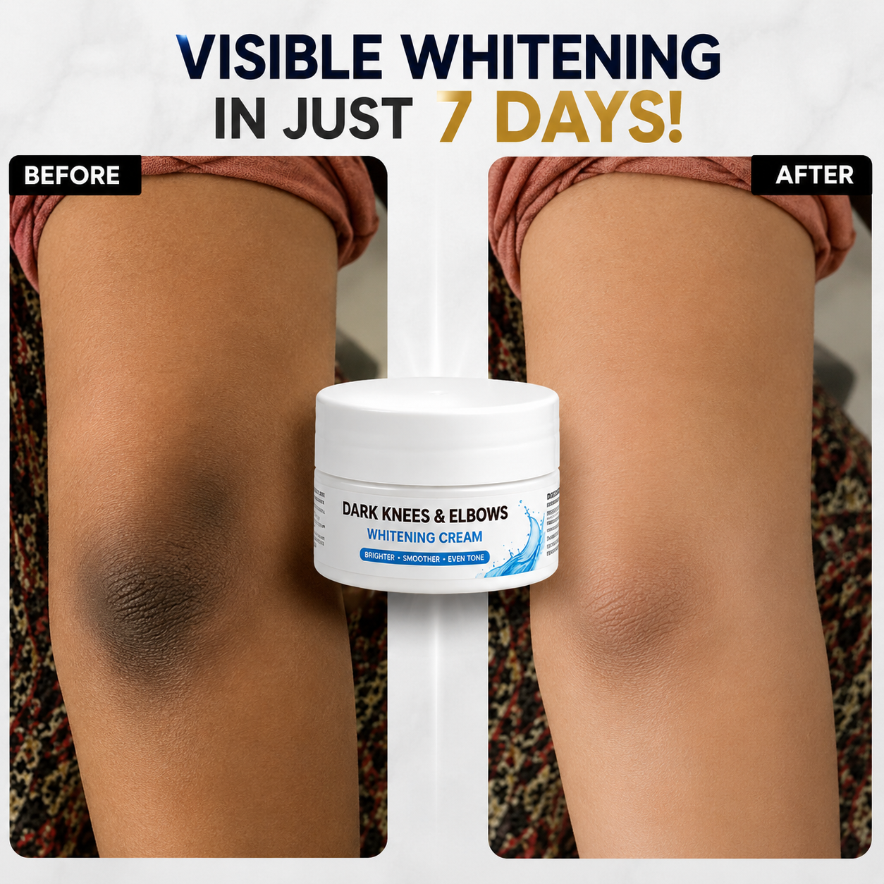 DARK KNESS & ELBOWS WHITENING CREAM